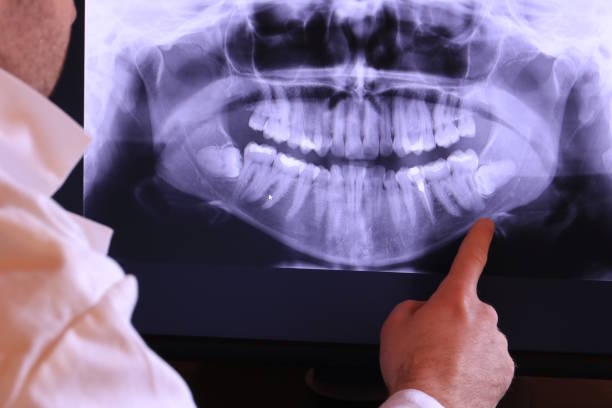 Best Emergency Tooth Extraction  in Edneyville, NC