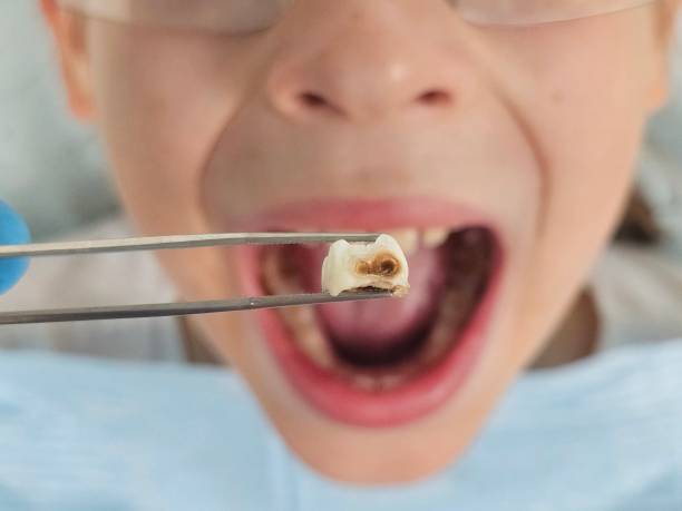 Best Dentist for Tooth Abscess  in Edneyville, NC
